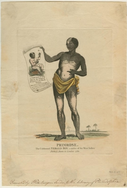 Primrose: The Celebrated Piebald boy, a Native of the West Indies; Publicly [sic] Shewn in London 1789 (London: Printed and sold at [T. Pole?], No. 55 Graceh. Strt, ca. 1790). Hand-colored engraving.